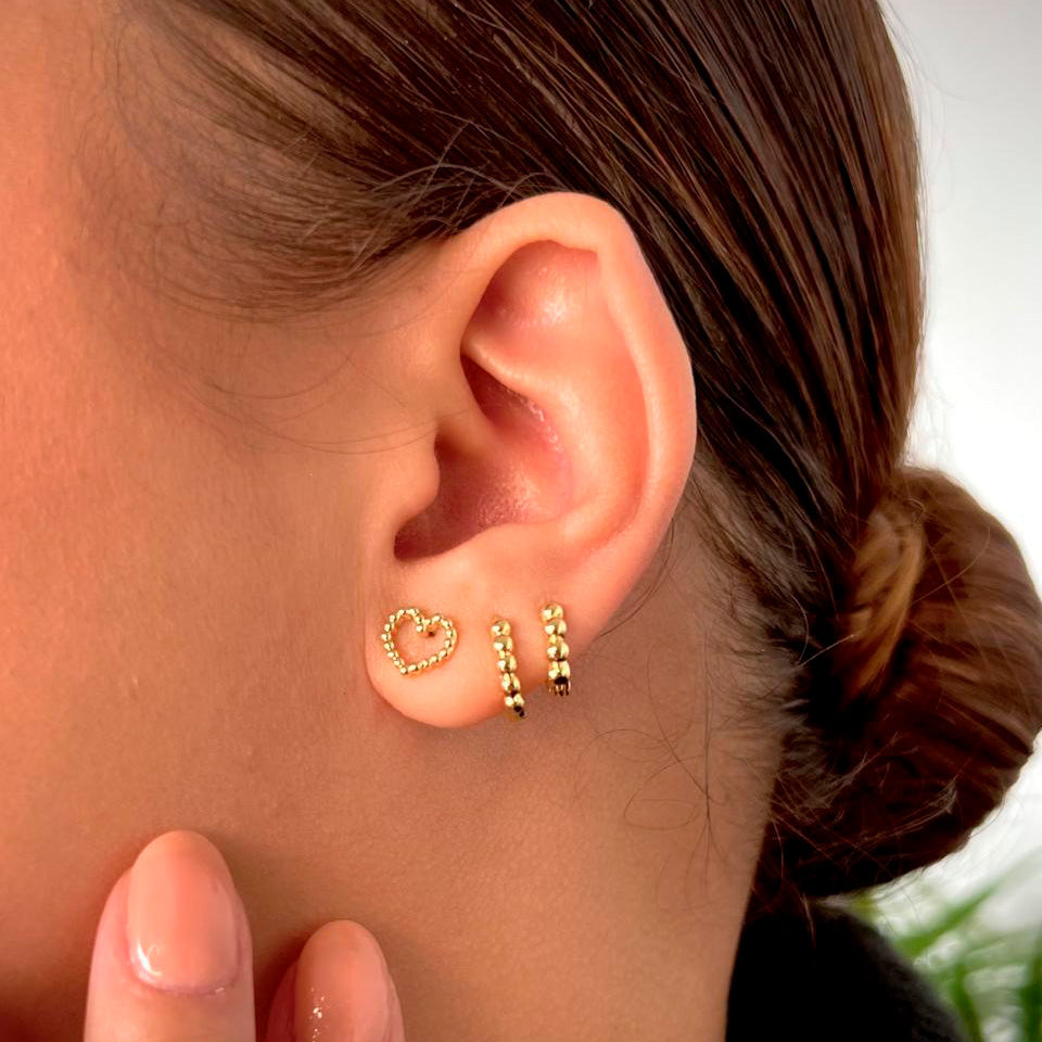 Arete Candonga Esfera P